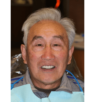 Denture patient after dental treatment with Dr. Rice