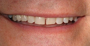 patient suffered from severe headaches and needed a better smile