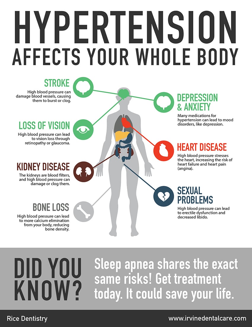Rice Dentistry Sleep Apnea Infographic