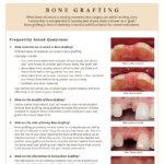 Information on bone grafting
