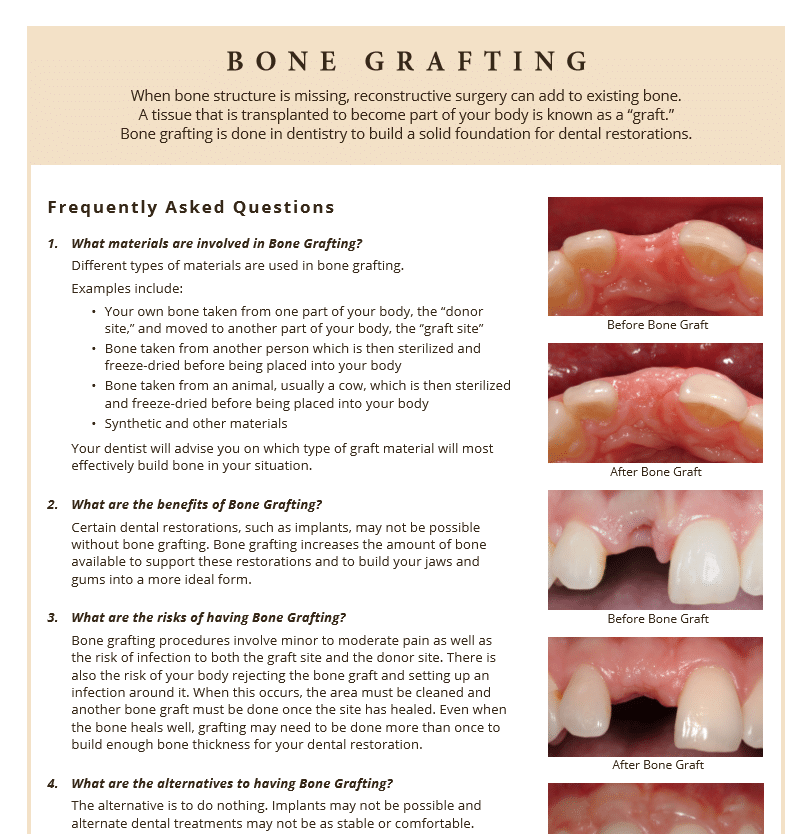 Information on bone grafting