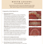Different colored areas in the mouth and what they mean
