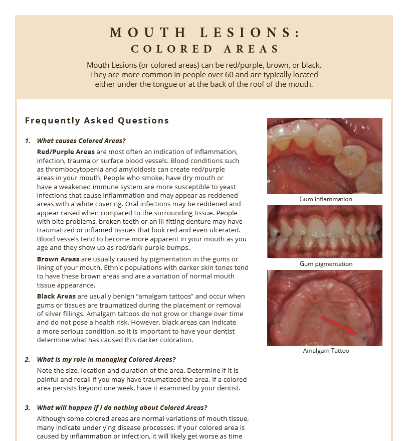 Different colored areas in the mouth and what they mean
