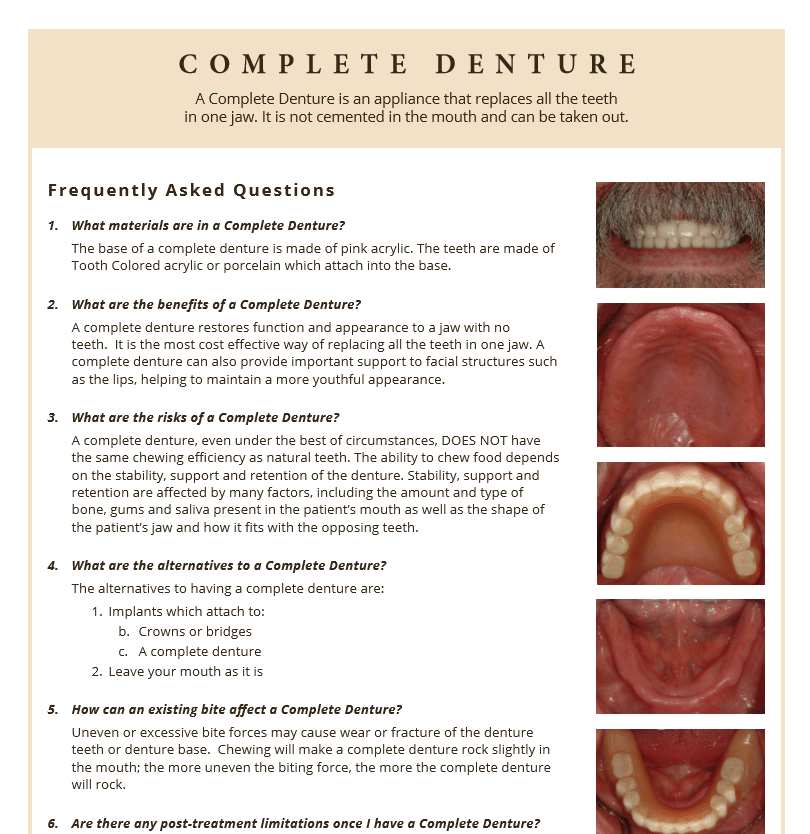 Complete denture benefits and questions