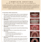 Complete denture with 2 or 4 locator attachments