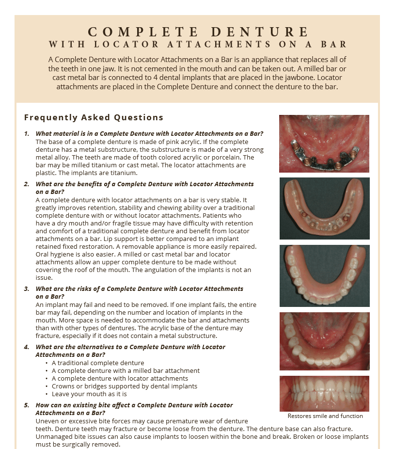 Complete denture care FAQ's