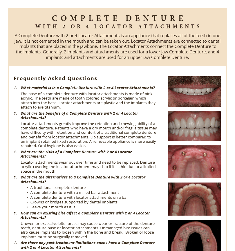 Complete denture with 2 or 4 locator attachments