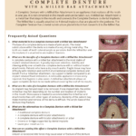FAQ's on full dentures and benefits