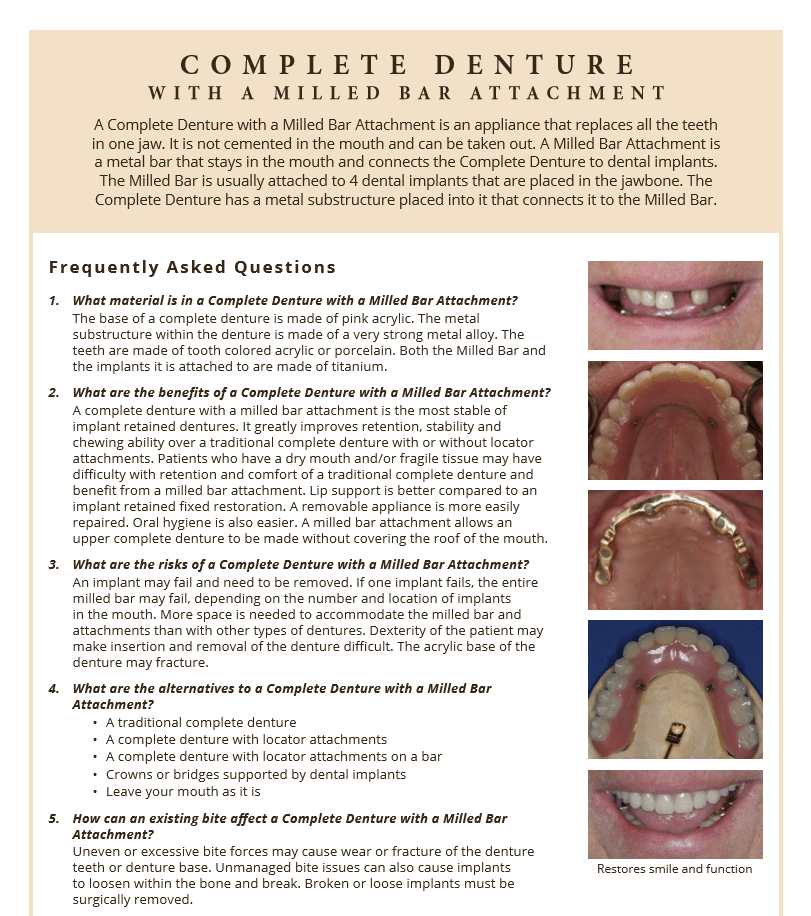 FAQ's on full dentures and benefits