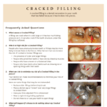 Information on cracked fillings and how to minimize risk