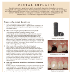 FAQ's on dental implants