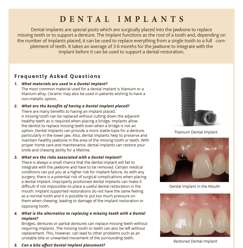 FAQ's on dental implants