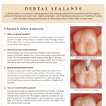Flyer showing information on dental sealants