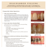 Discolored fillings FAQ