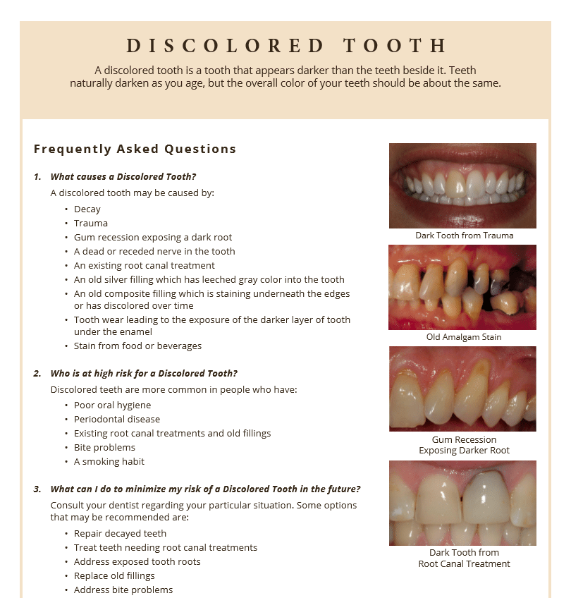 Discolored teeth FAQ's