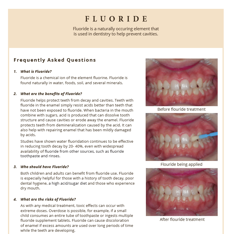 Information on fluoride treatment
