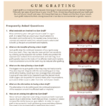 Gum Grafter questions and answers on alternatives