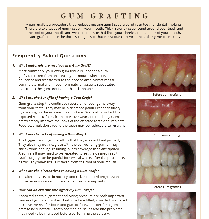Gum Grafter questions and answers on alternatives
