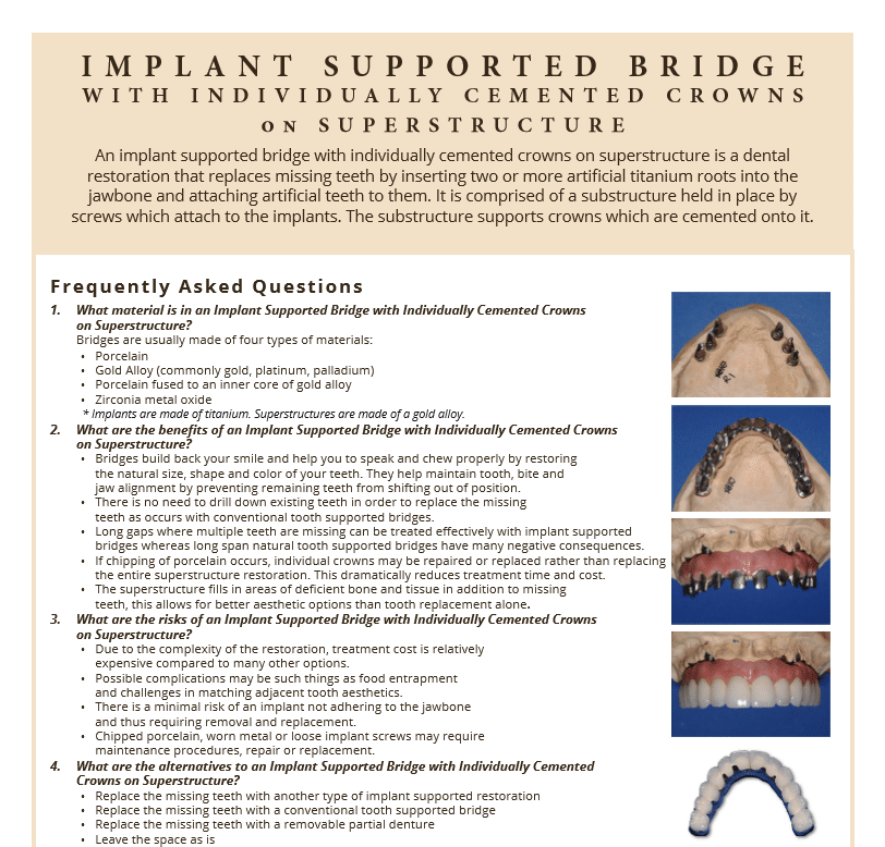 Implant Supported bridge faq's