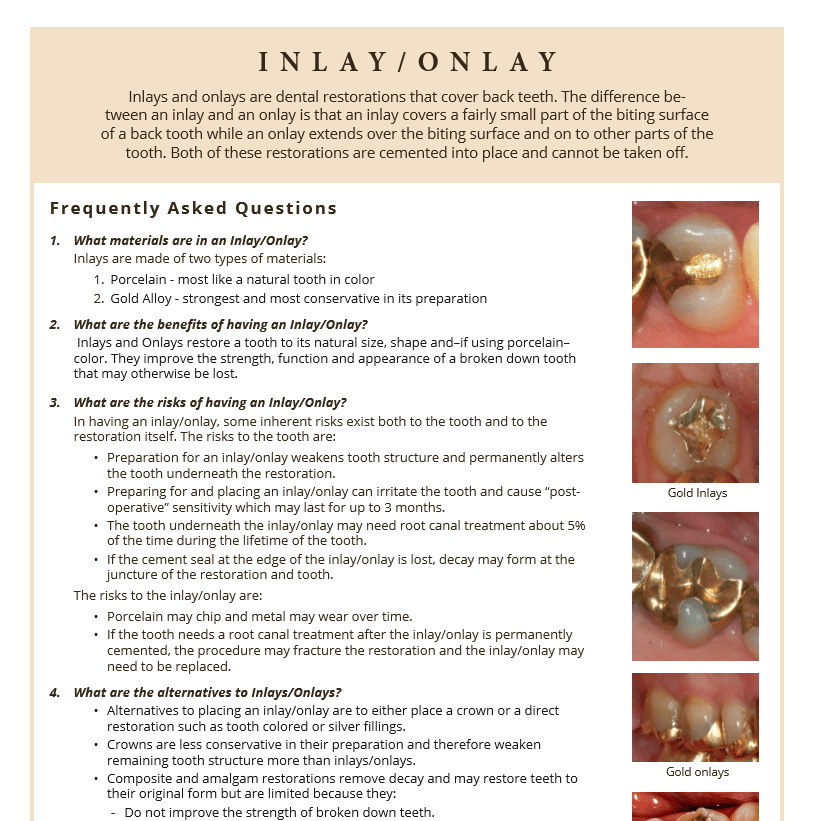 Inlay and Onlay fact sheet