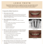 Information on the causes of loose teeth