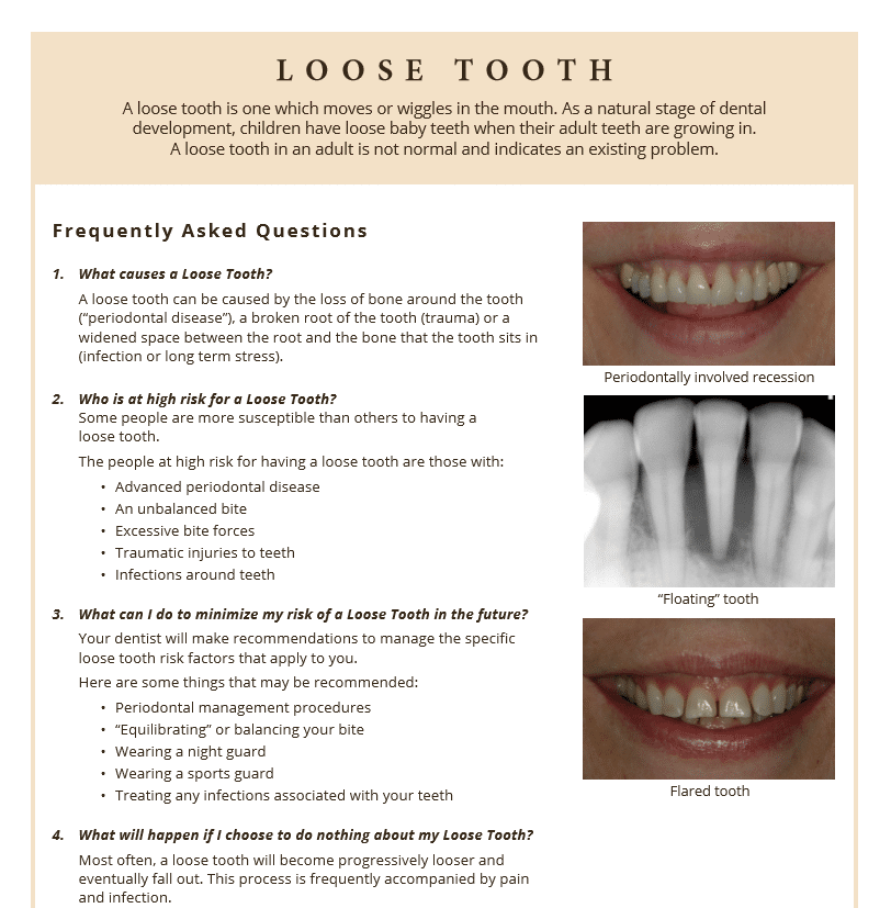 Information on the causes of loose teeth