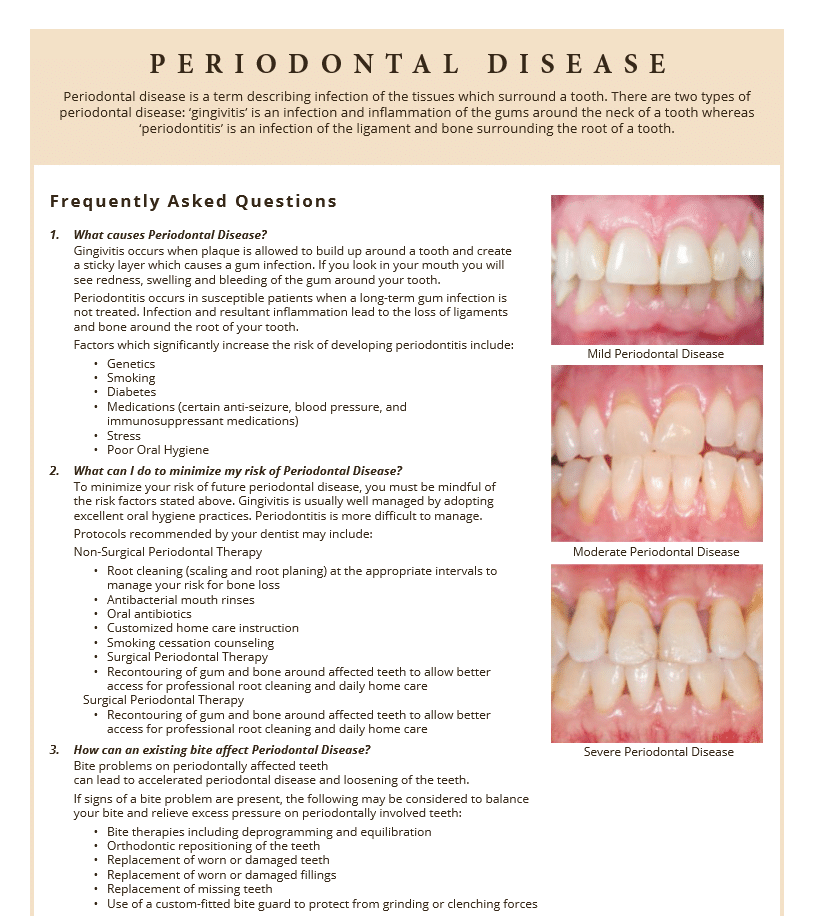 Periodontal Disease information