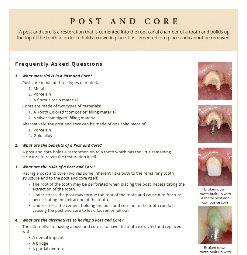 Post and Core restoration fact sheet