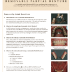 FAQ's for Removable partial denture information