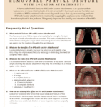 Removable partial denture information