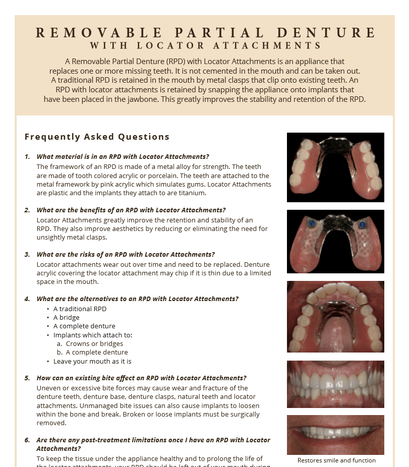 Removable partial denture information