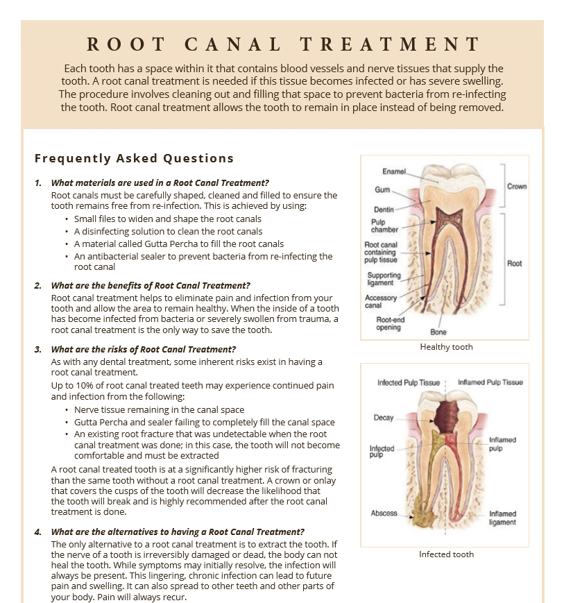 Root Canal treatment FAQ's