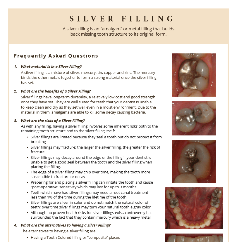Silver fillings fact sheet