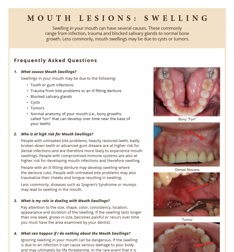 Swelling and affect of mouth lesions