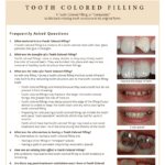 Tooth colored information