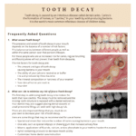 Information on tooth decay and how to minimize risk