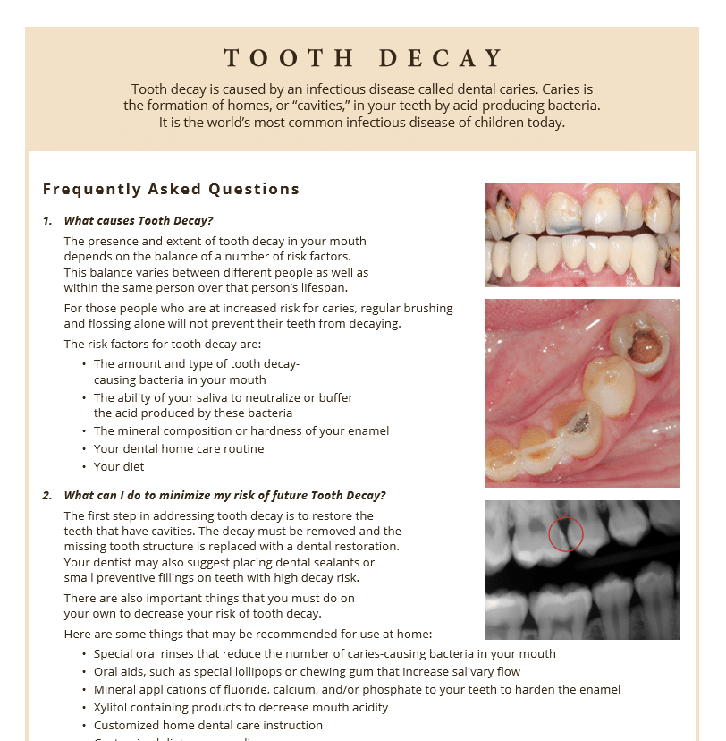 Information on tooth decay and how to minimize risk