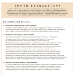 FAQ's on tooth extractions
