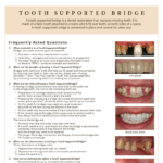 Tooth support bridge information