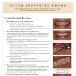 Tooth supported crown information