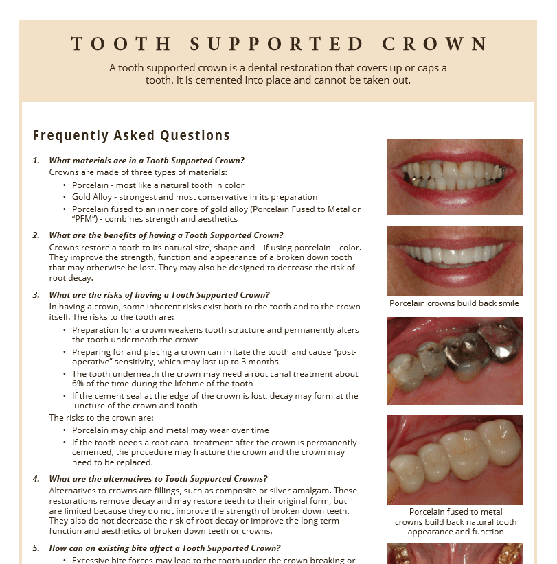 Tooth supported crown information