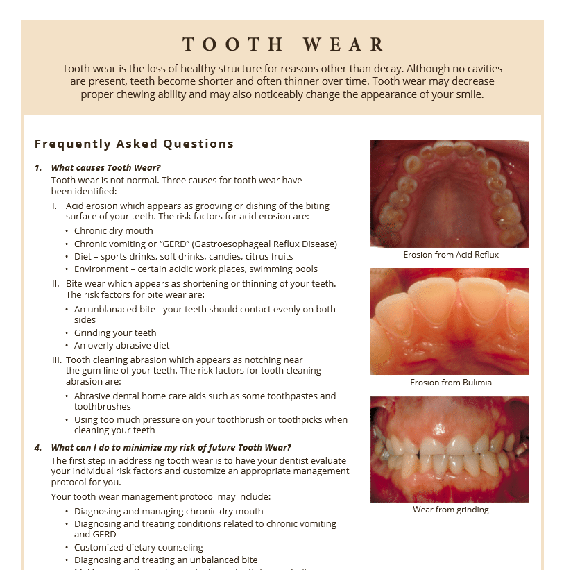 Tooth wear and decay FAQ's