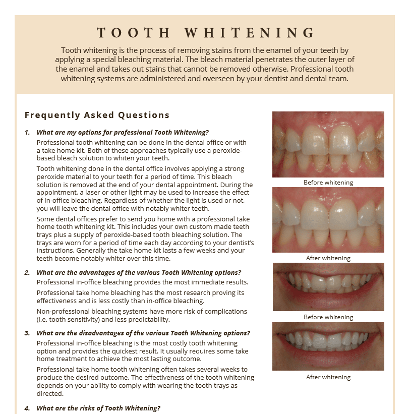 Teeth Whitening FAQ's