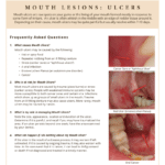 Mouth lesions and ulcers and managing their risks