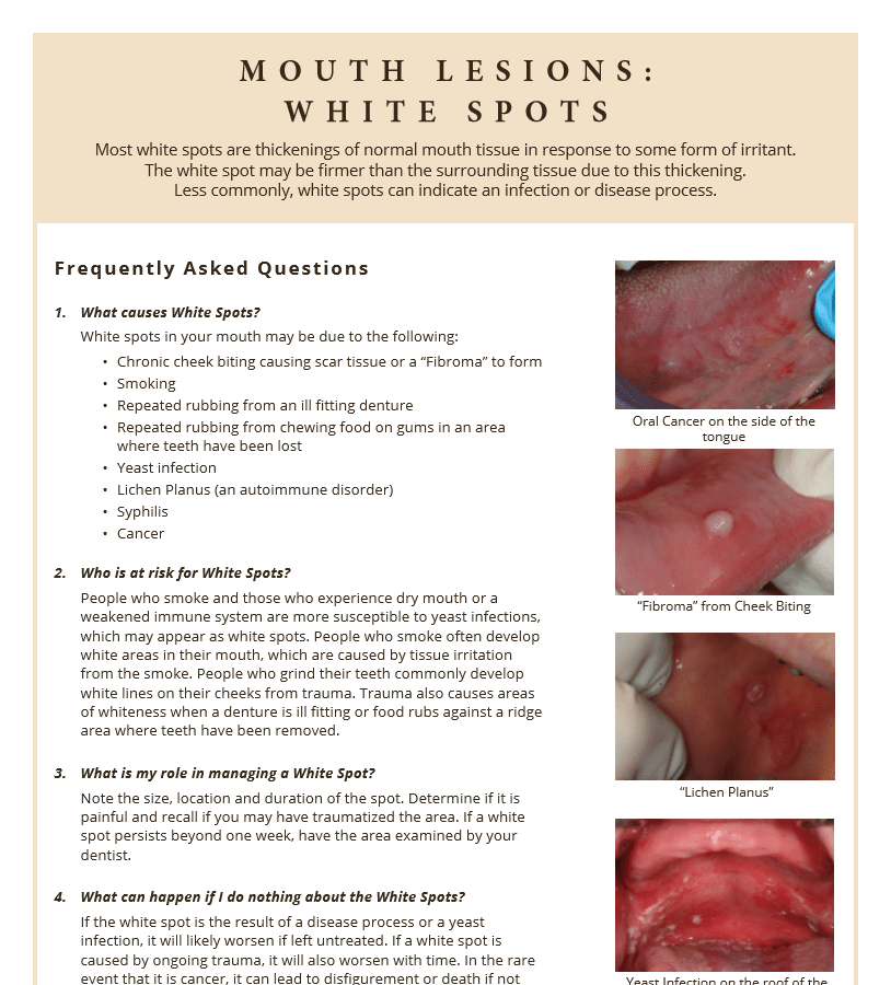 Questions and answers about white spots and mouth lesions