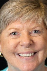 Kay-Hendricks-post-op-face-smile-min A post op photo of a patient who found a reason to smile again with All-On-4® Implant Dentures