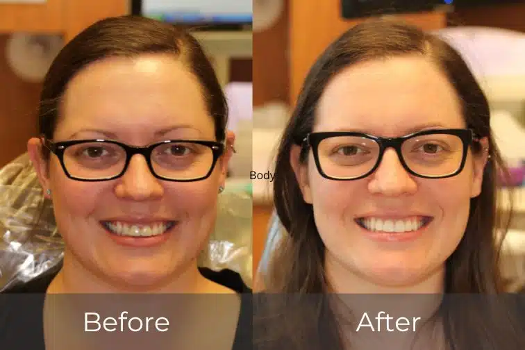 Patient of Rice Dentistry